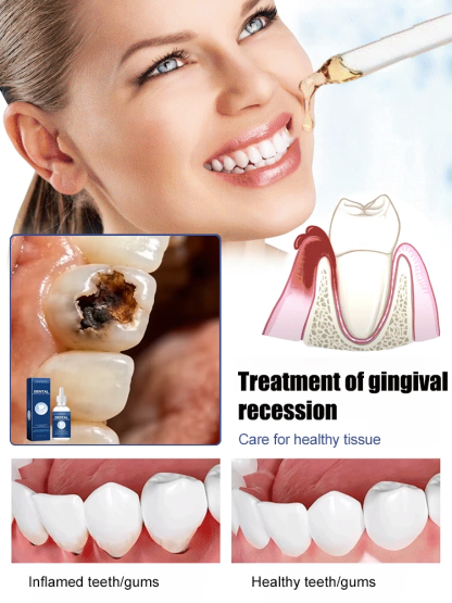 Tooth Regeneration Care Drops