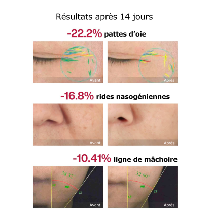 Appareil de beauté pour le visage Vellera™ S1 Pro