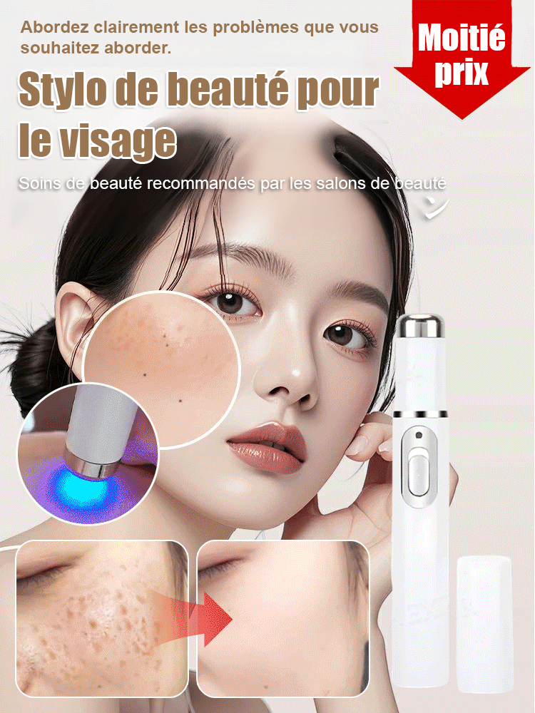 Stylo laser pour éliminer les verrues sans douleur✨️Dites adieu aux verrues sans douleur, pour une peau lisse et éclatante !