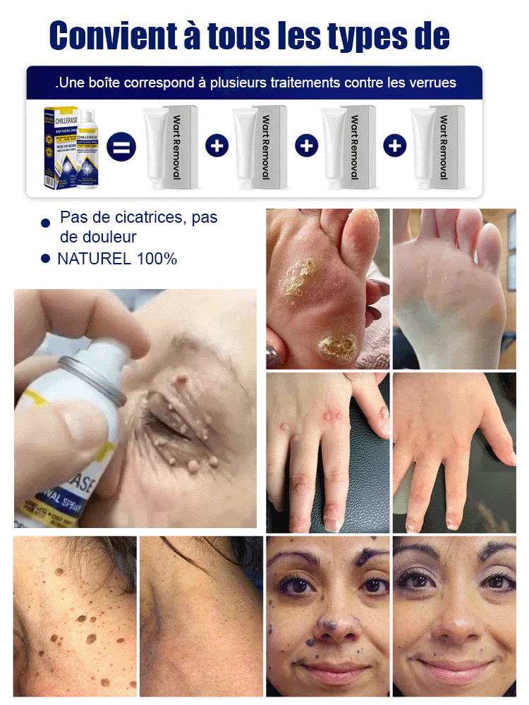 Brume Rafraîchissante et Apaisante✨️Peau Claire & Douce en 1 Semaine (100% Naturel)👍️