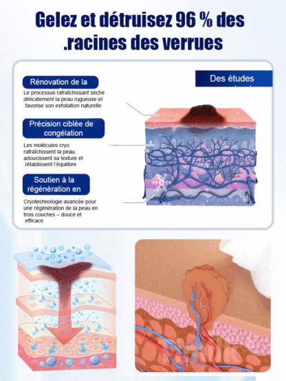 Brume Rafraîchissante et Apaisante✨️Peau Claire & Douce en 1 Semaine (100% Naturel)👍️