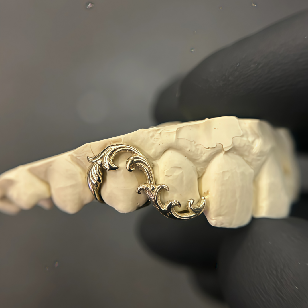 Vintage Baroque Grillz – Luxury Dental Jewelry