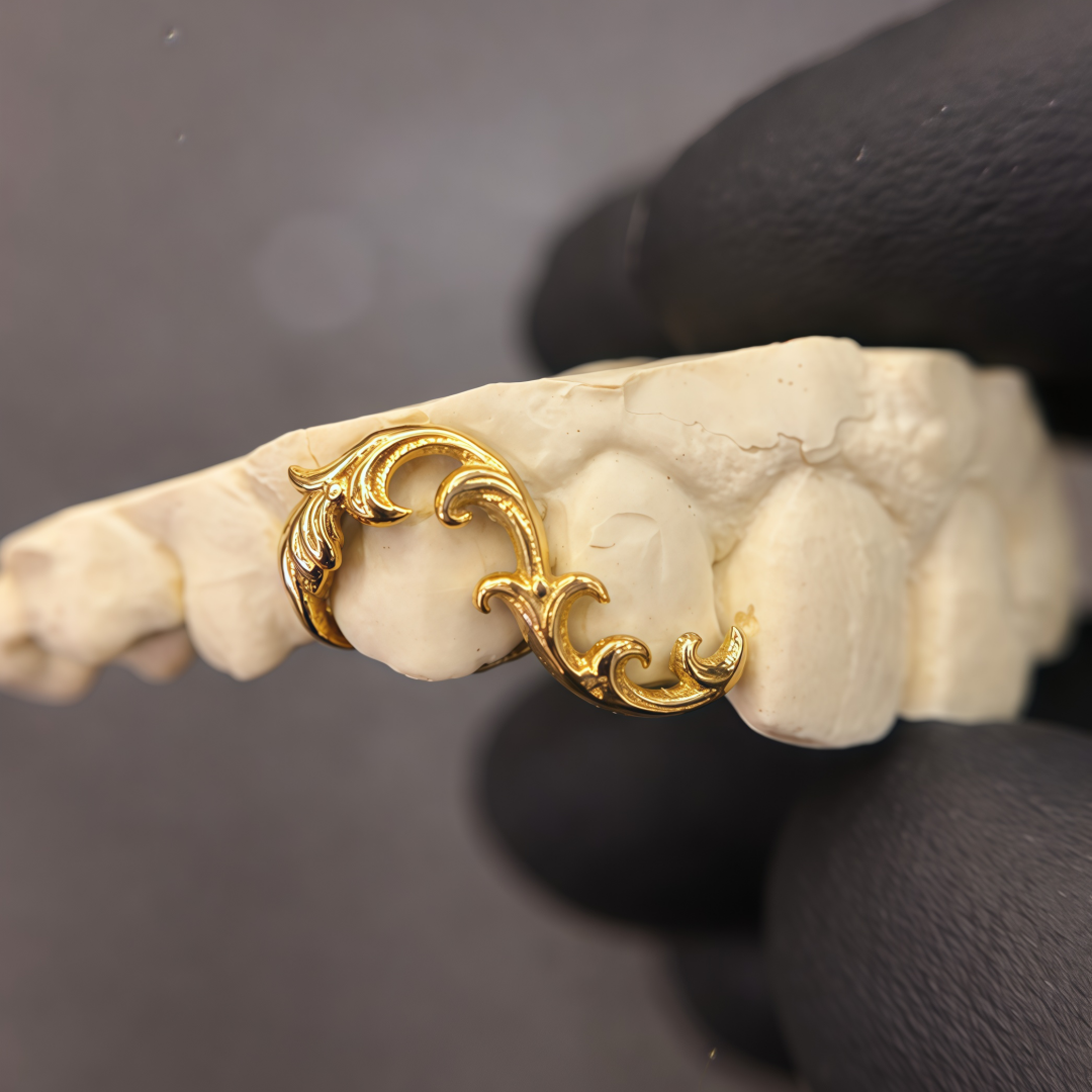 Vintage Baroque Grillz – Luxury Dental Jewelry