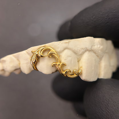 Vintage Baroque Grillz – Luxury Dental Jewelry