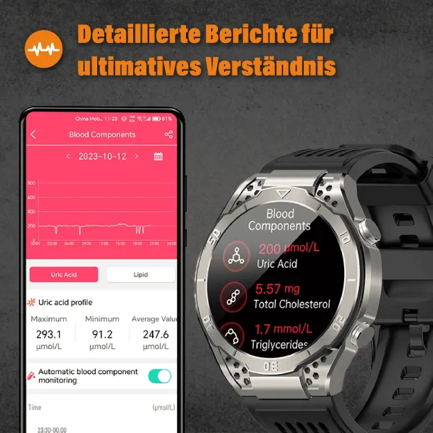 Apollo - EKG Smartwatch