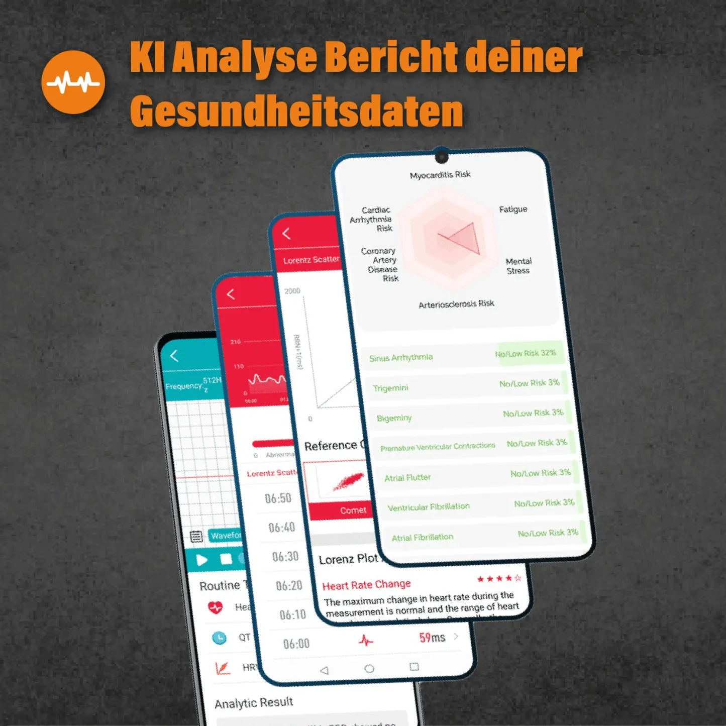 Apollo - EKG Smartwatch