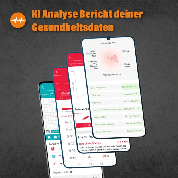 Apollo - EKG Smartwatch