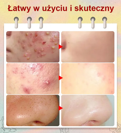 Estetyka bez skazy ✨Zacisk komórek o wysokiej precyzji i twardości💎🧖‍♀️ Zmiana tekstury czystej skóry