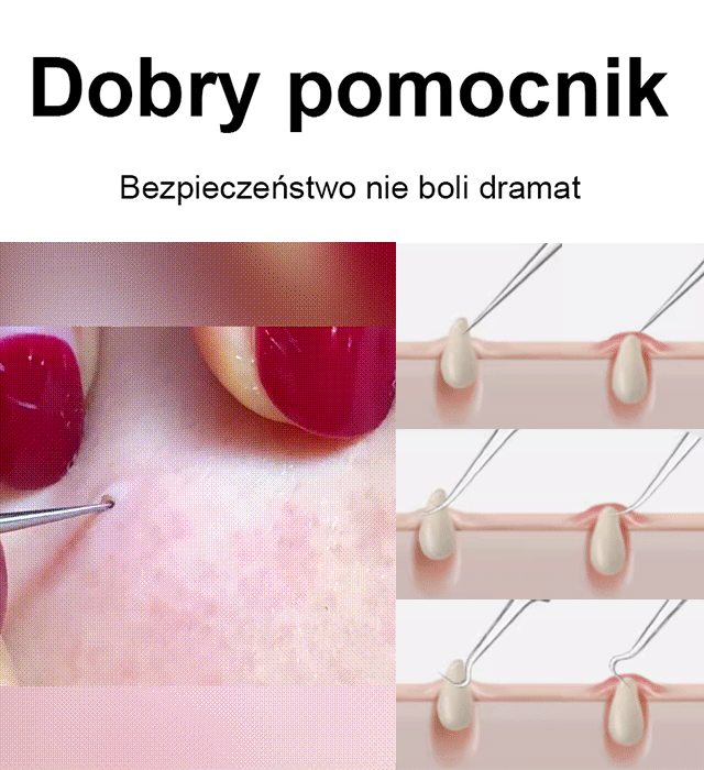 Estetyka bez skazy ✨Zacisk komórek o wysokiej precyzji i twardości💎🧖‍♀️ Zmiana tekstury czystej skóry