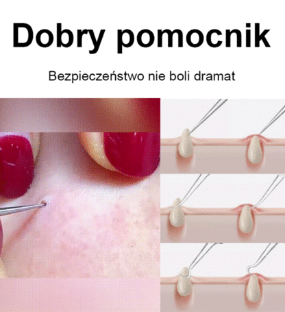 Estetyka bez skazy ✨Zacisk komórek o wysokiej precyzji i twardości💎🧖‍♀️ Zmiana tekstury czystej skóry