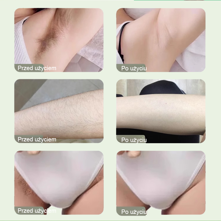 Usuwa włosy w zaledwie 30 sekund i zapewnia gładką skórę nawet na 3 miesiące!