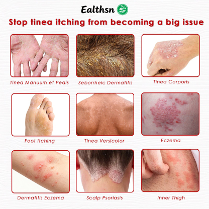 Ealthsn® Herbal Miracle Cream for Jock Itch (Tinea Cruris)