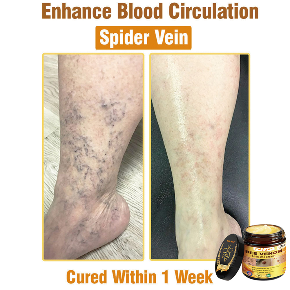 Ealthsn™ Bee Venom All-in-One Cream US Dermatologist Approved
