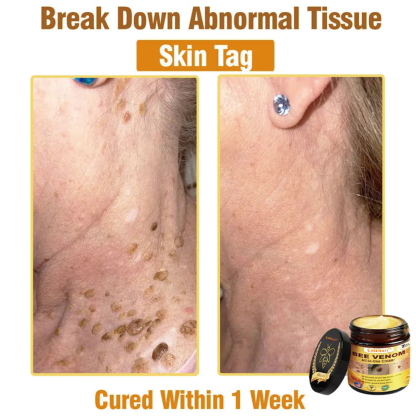 Ealthsn™ Bee Venom All-in-One Cream US Dermatologist Approved