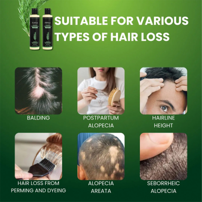 Clean Care for Stronger Hair| Ealthsn™ Rosemary Hydrolyzed Keratin Shampoo