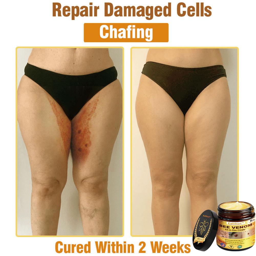 Ealthsn™ Bee Venom All-in-One Cream US Dermatologist Approved