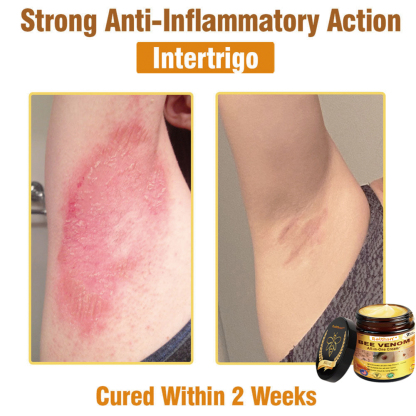 Ealthsn™ Bee Venom All-in-One Cream US Dermatologist Approved