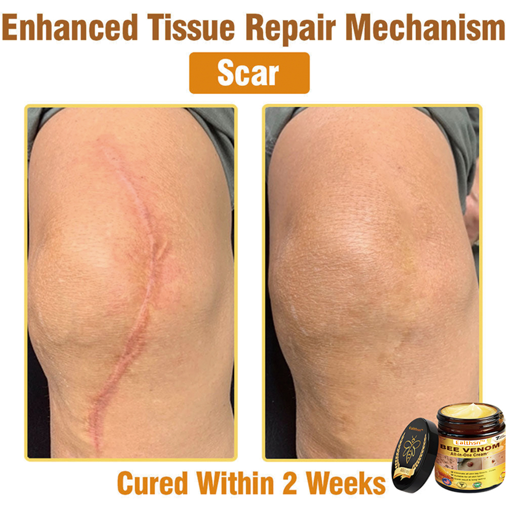 Ealthsn™ Bee Venom All-in-One Cream US Dermatologist Approved