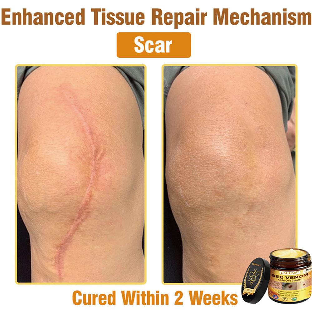 Ealthsn™ Bee Venom All-in-One Cream US Dermatologist Approved