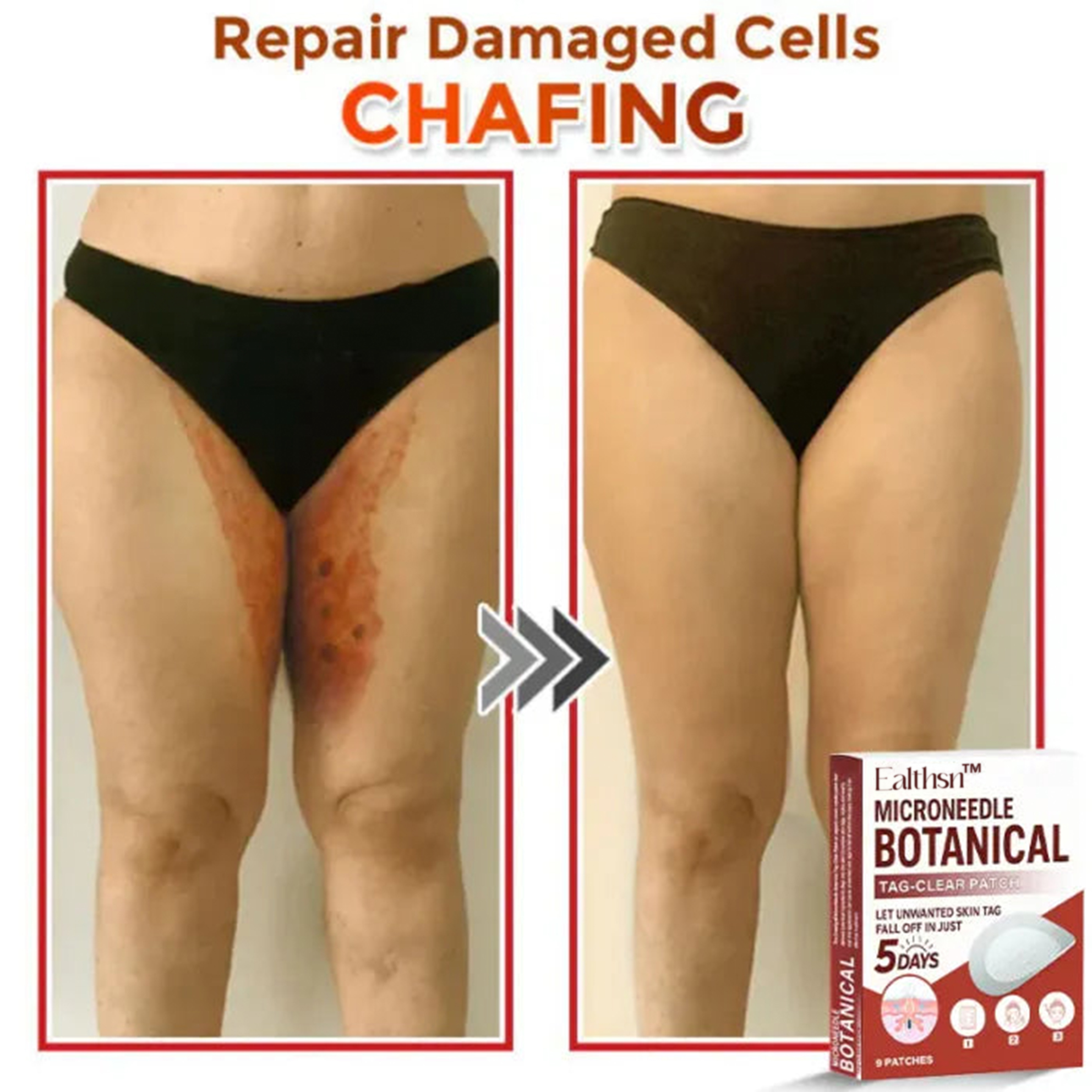 Ealthsn™ MicroNeedle Botanic Skin Tag Removal Patch