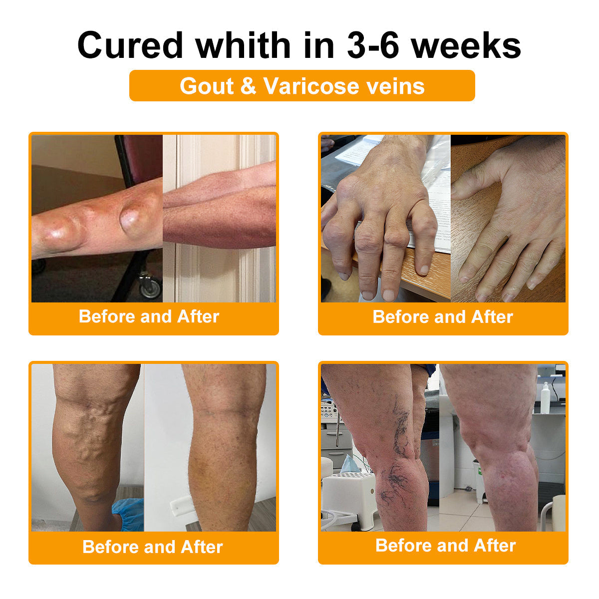 🐝ODALIT™ Botulinum Toxin & Bee Venom Pain-Relief Bone Healing Cream 🐝💎