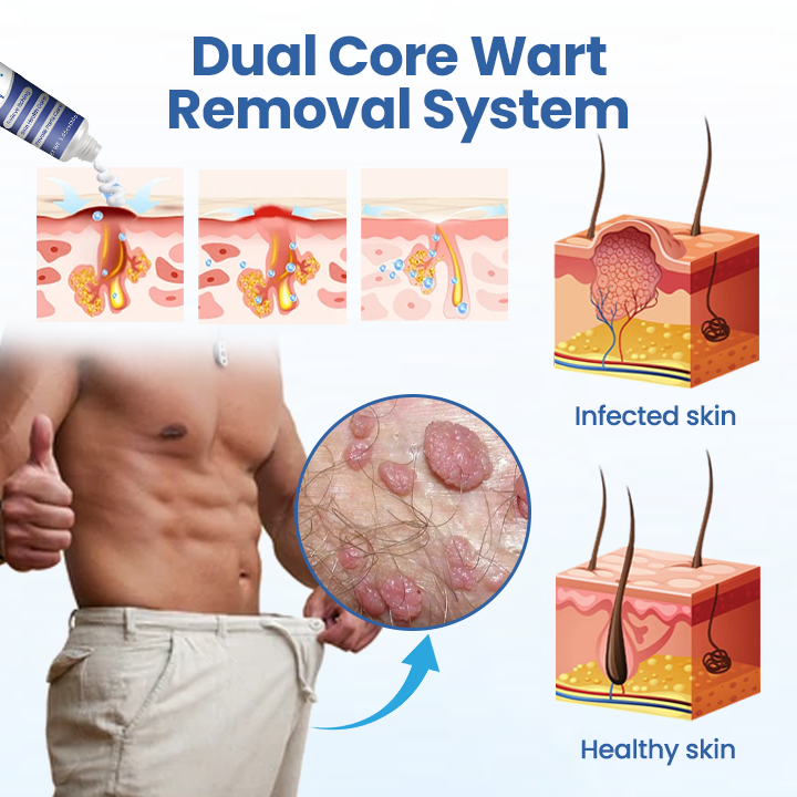 Ealthsn™ GentX WartRelief Cream