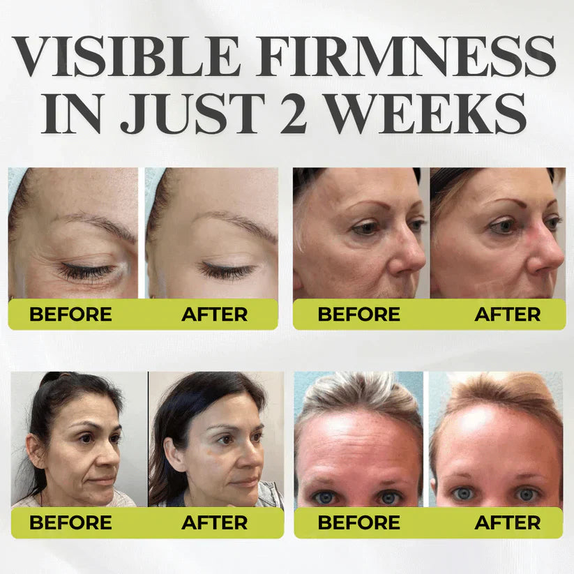 👏🌿Made and shipped from the USA 💫Ealthsn™ Botox & Vita-A Retinol Shot Wrinkle-Lift Tightening cream - Last Day Promotion 70% OFF