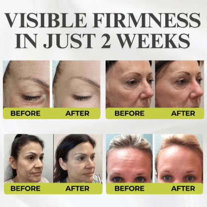 👏🌿Made and shipped from the USA 💫Ealthsn™ Botox & Vita-A Retinol Shot Wrinkle-Lift Tightening cream - Last Day Promotion 70% OFF