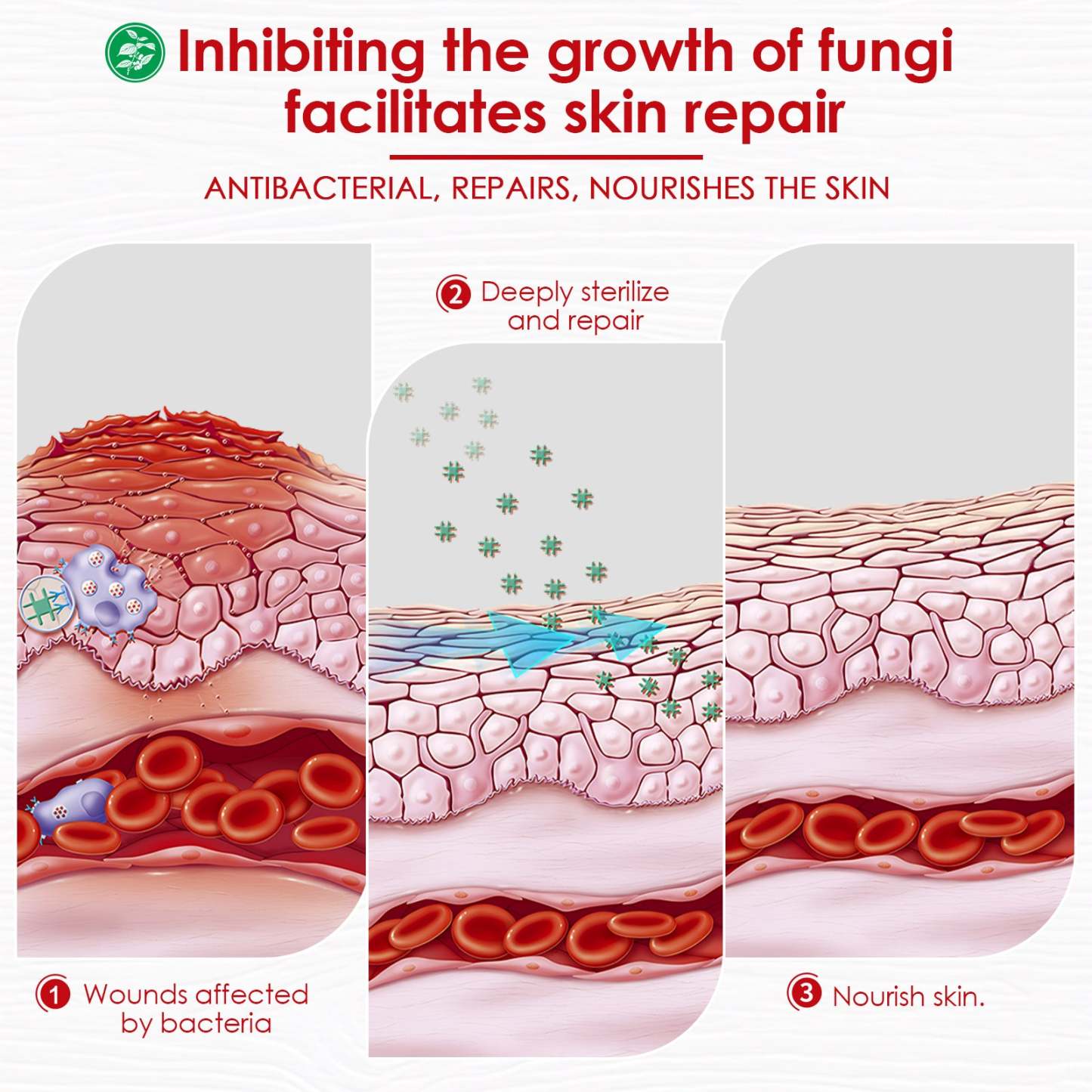 Ealthsn® Herbal Miracle Cream for Jock Itch (Tinea Cruris)