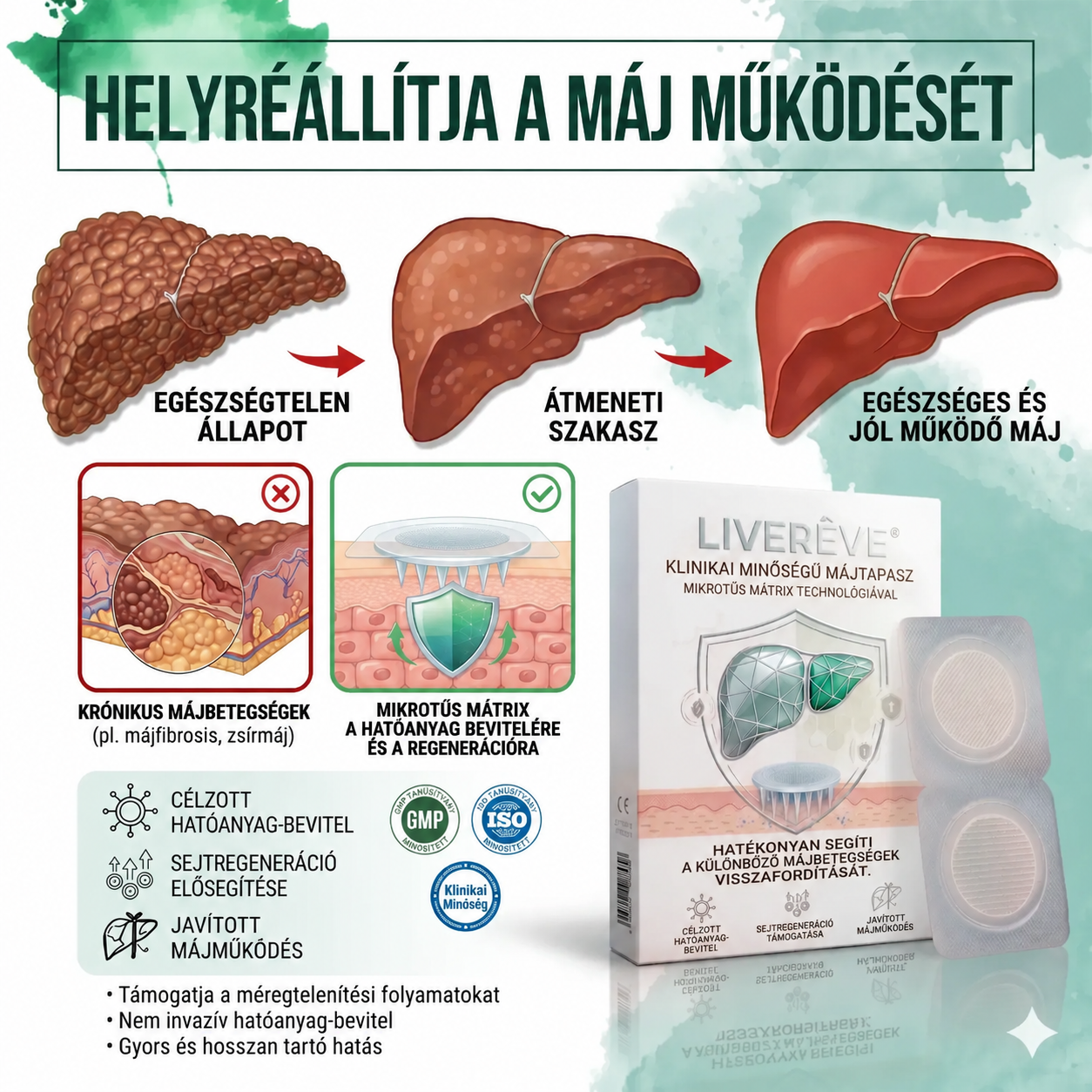 LIVERÊVE® Nano Microneedle Májtámogató Tapasz - Hatékony Májtámogatás - Méregtelenítés és Javítás - Csökkenti a Vércukorszintet és a Lipideket