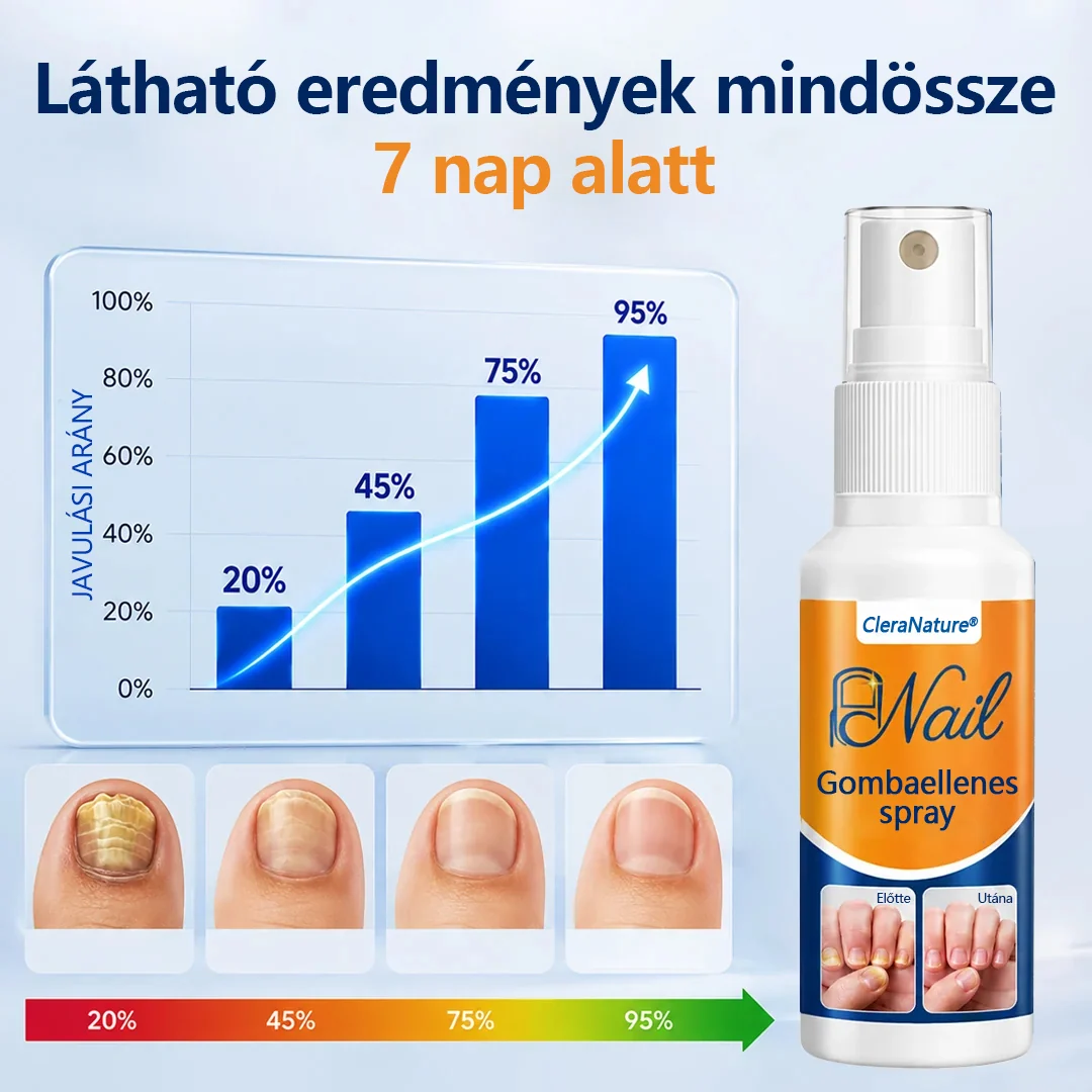 CleraNature® körömgomba-könnyítő spray  🎉 180 napos pénzvisszafizetési garancia – próbáld ki kockázat nélkül.