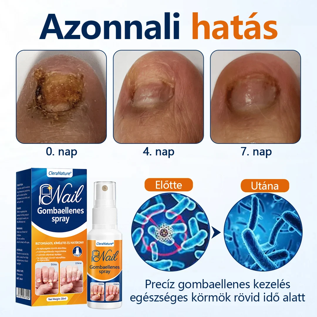 CleraNature® körömgomba-könnyítő spray  🎉 180 napos pénzvisszafizetési garancia – próbáld ki kockázat nélkül.