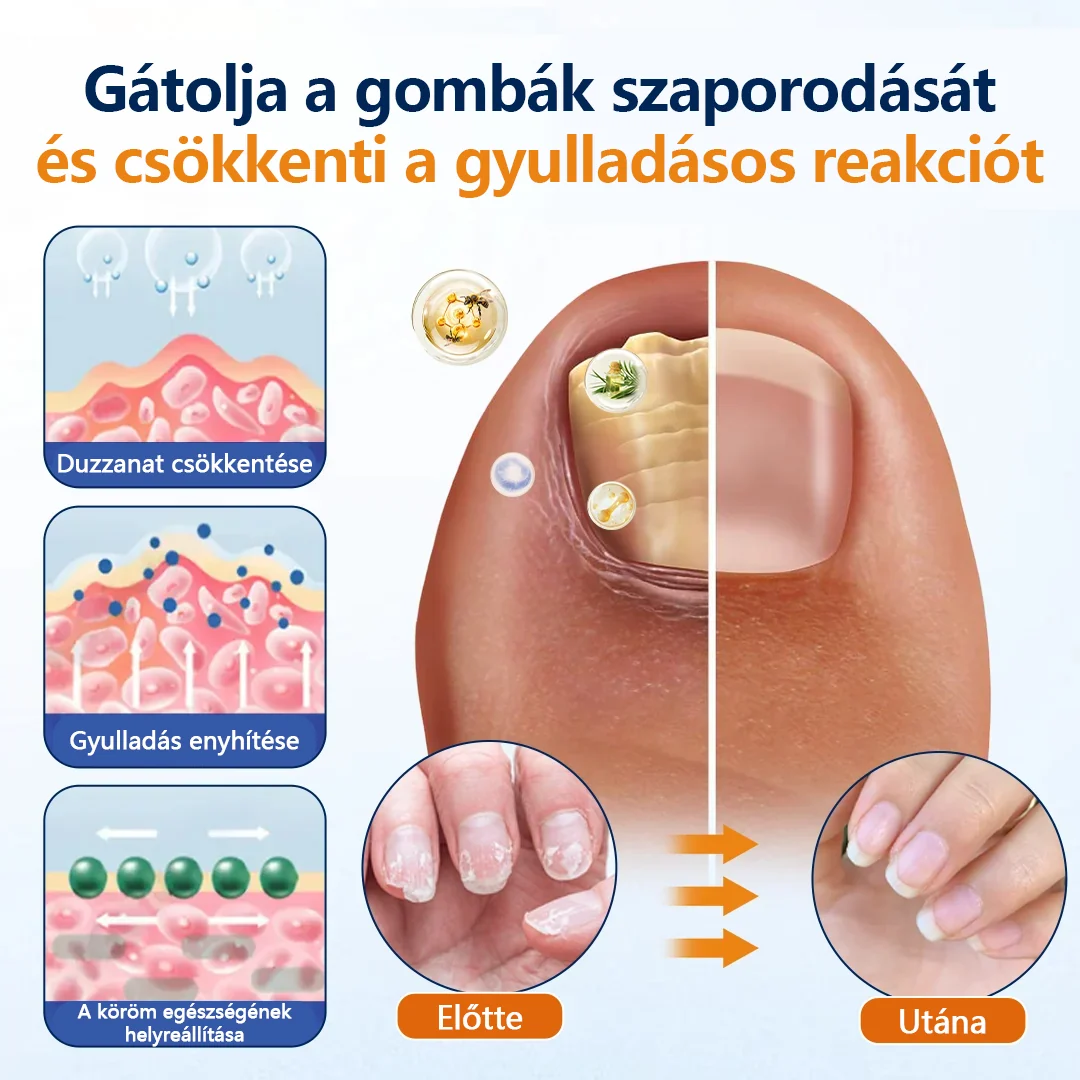 CleraNature® körömgomba-könnyítő spray  🎉 180 napos pénzvisszafizetési garancia – próbáld ki kockázat nélkül.