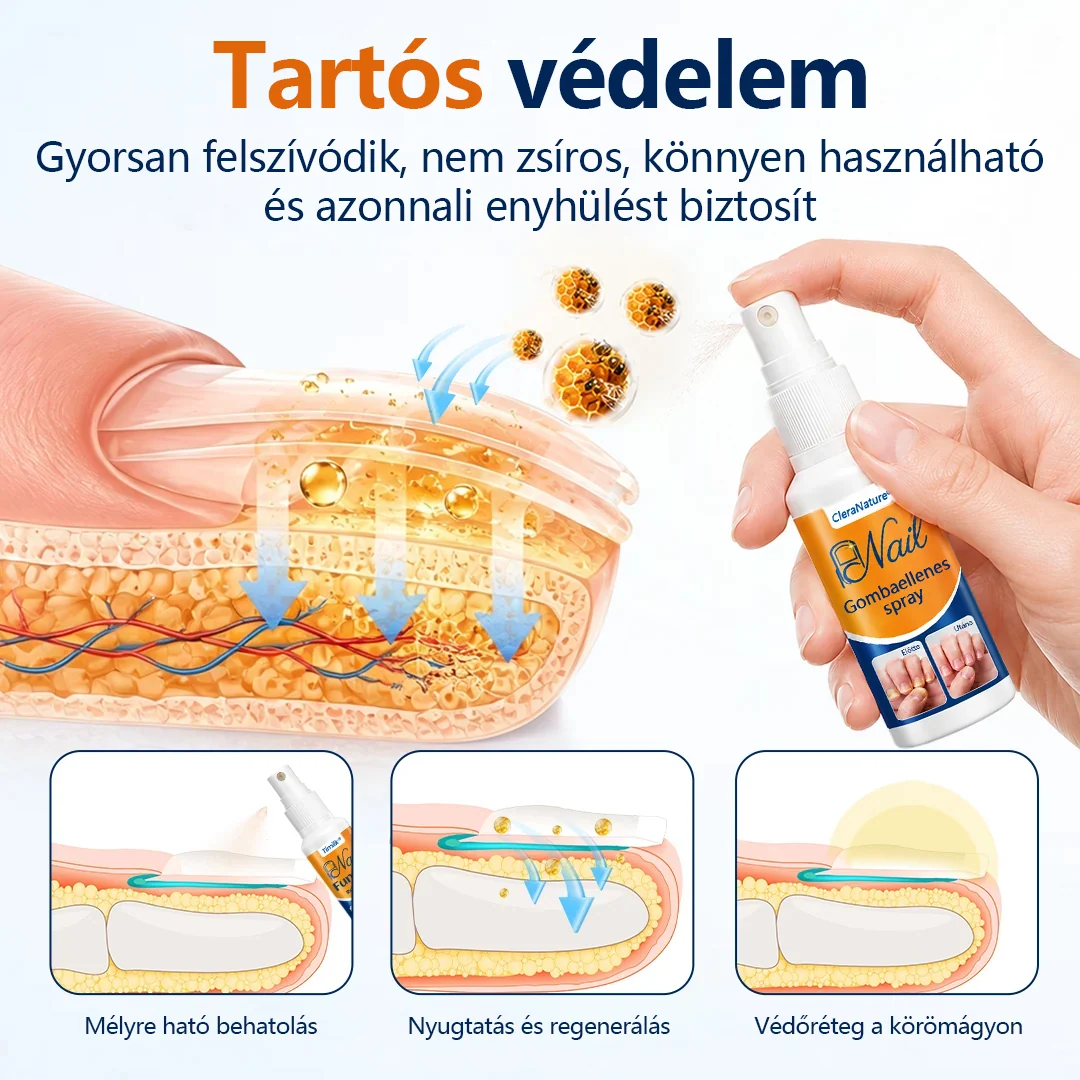 CleraNature® körömgomba-könnyítő spray  🎉 180 napos pénzvisszafizetési garancia – próbáld ki kockázat nélkül.