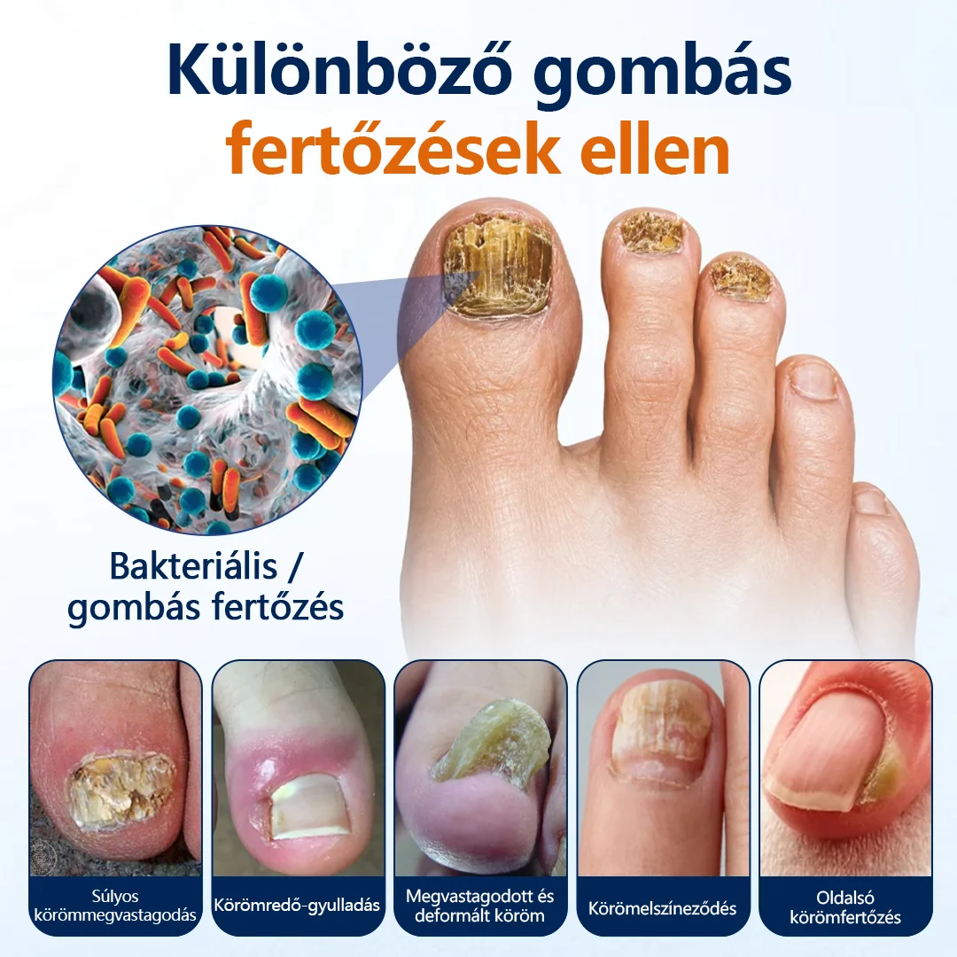 CleraNature® körömgomba-könnyítő spray  🎉 180 napos pénzvisszafizetési garancia – próbáld ki kockázat nélkül.