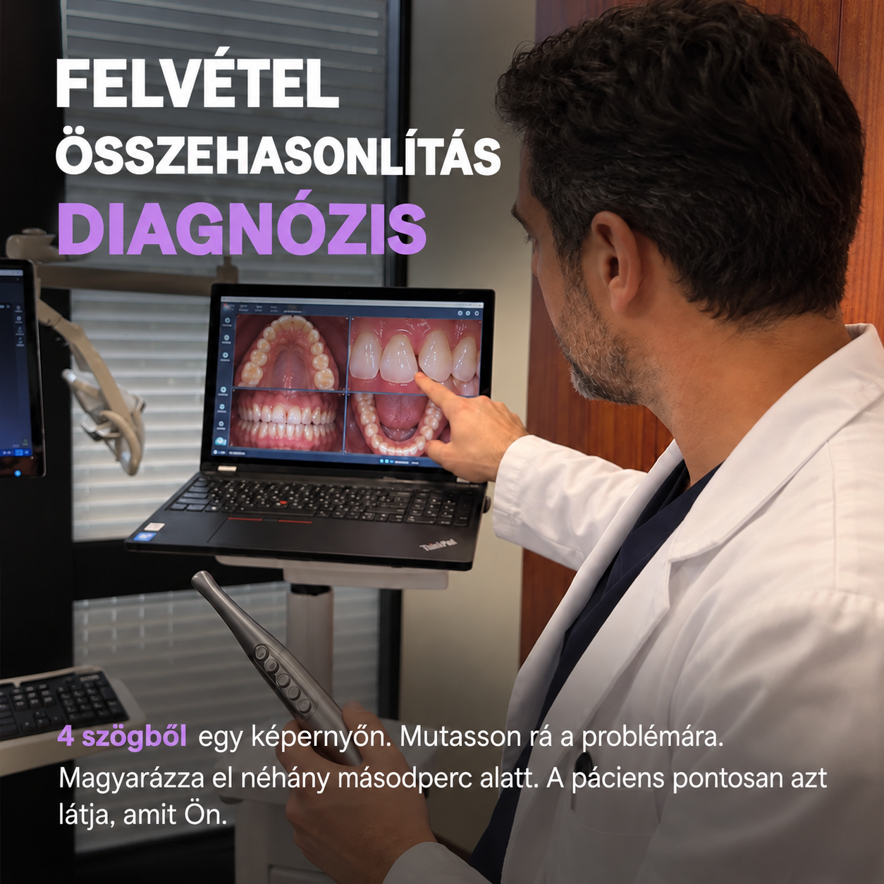 [Copy]Lumineux 10% Nano Hydroxyapatite fehérítő fogkrém, 3,75 oz, 2 db-os kiszerelés
