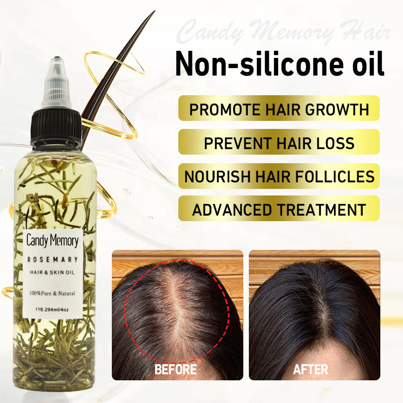 Herbal Heritage™ All-Natural Rosemary Hair Care Essential Oil