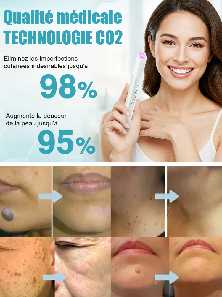  Stylo de soin cutané à laser doux pour enlever les grains de beauté et les verrues