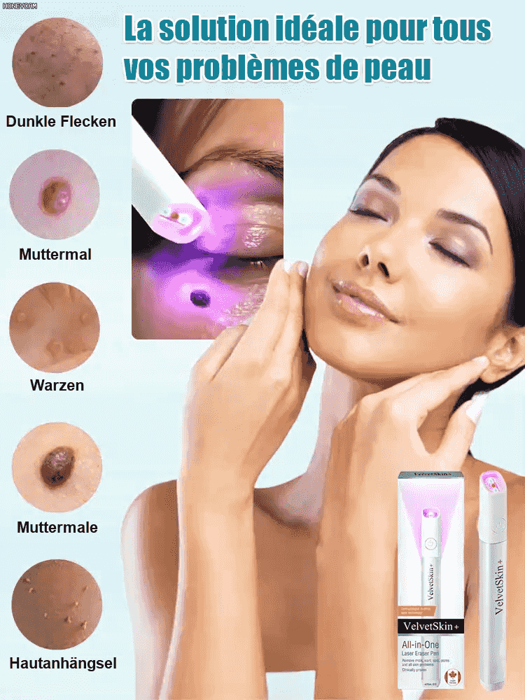  Stylo de soin cutané à laser doux pour enlever les grains de beauté et les verrues