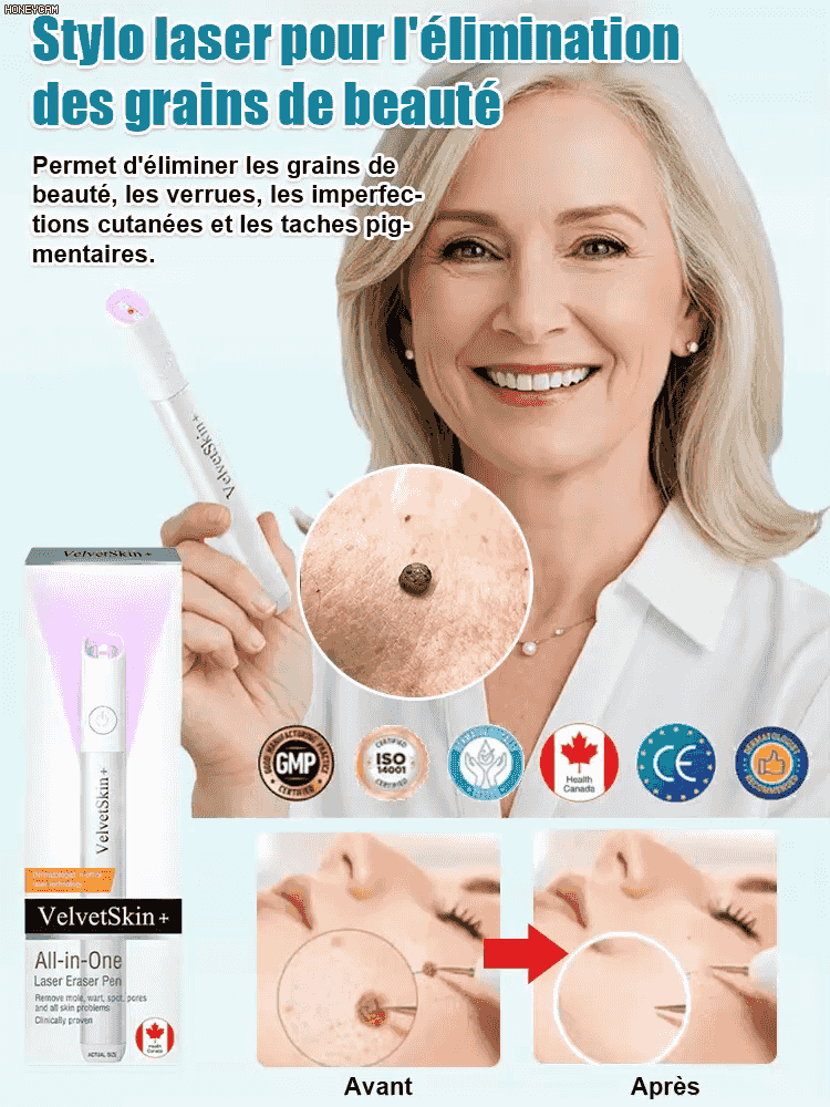  Stylo de soin cutané à laser doux pour enlever les grains de beauté et les verrues