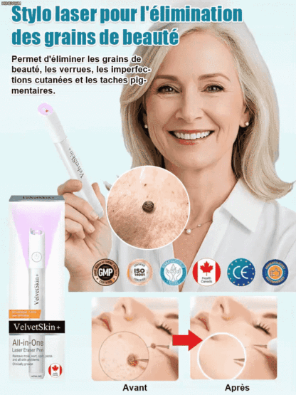  Stylo de soin cutané à laser doux pour enlever les grains de beauté et les verrues