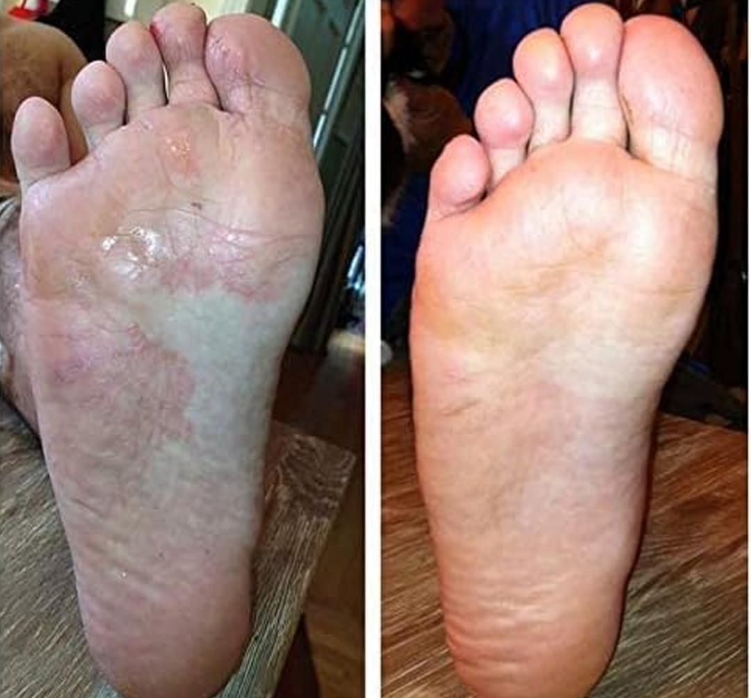 YUNPSO® AiryFilm Foot Defense Mist image YUNPSO® AiryFilm Foot Defense Mist