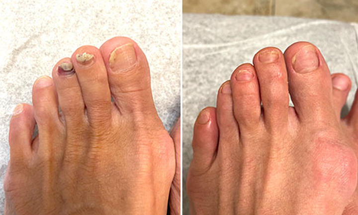 YUNPSO® AiryFilm Foot Defense Mist image YUNPSO® AiryFilm Foot Defense Mist