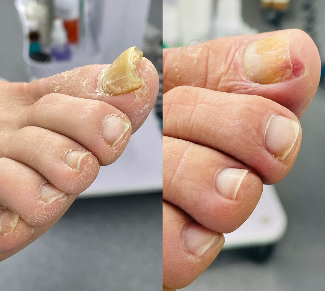 YUNPSO® AiryFilm Foot Defense Mist image YUNPSO® AiryFilm Foot Defense Mist