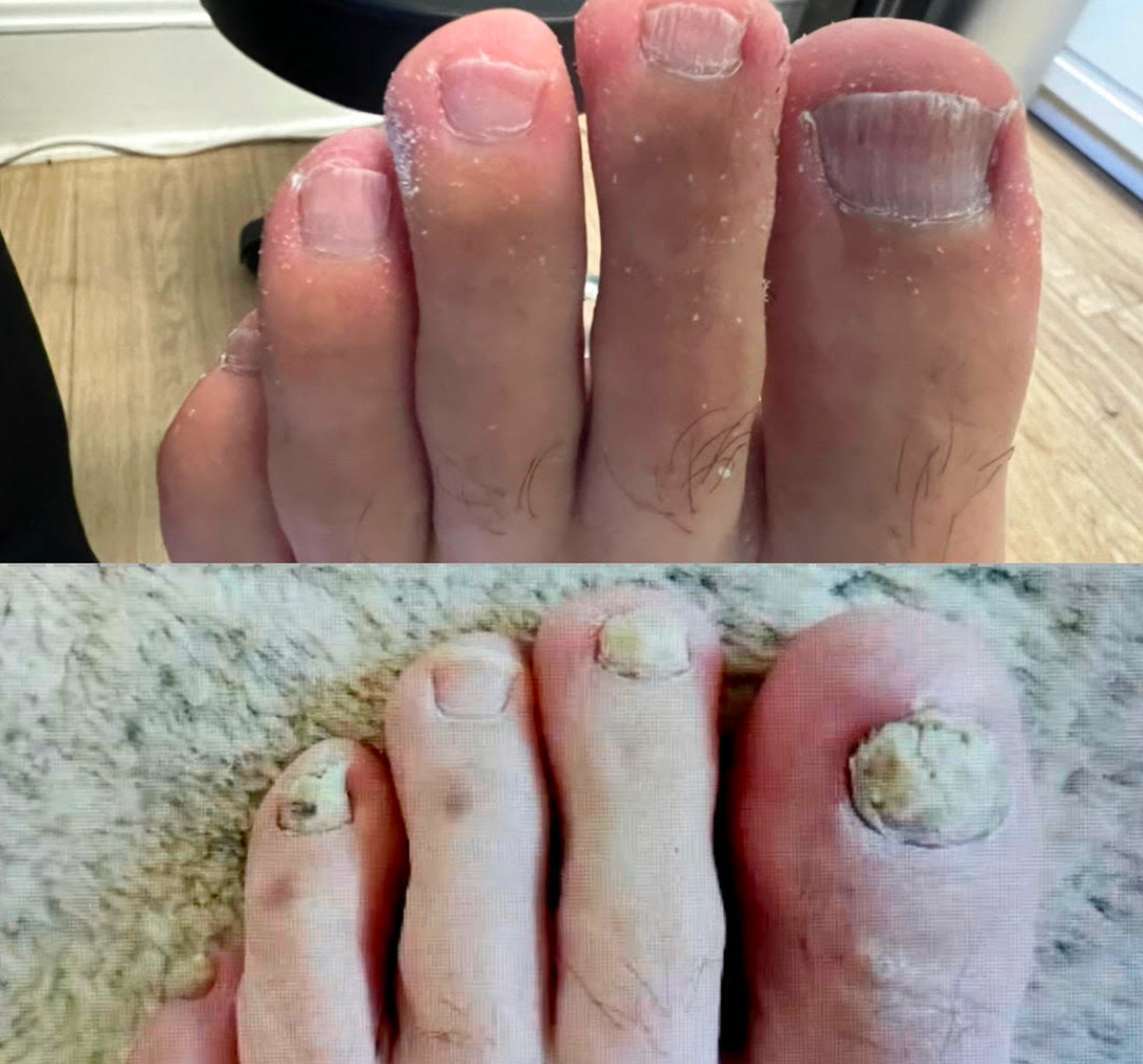 YUNPSO® AiryFilm Foot Defense Mist image YUNPSO® AiryFilm Foot Defense Mist