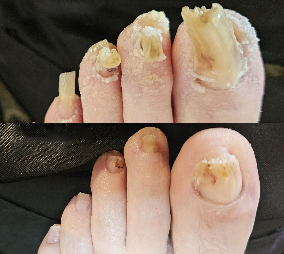 YUNPSO® AiryFilm Foot Defense Mist image YUNPSO® AiryFilm Foot Defense Mist