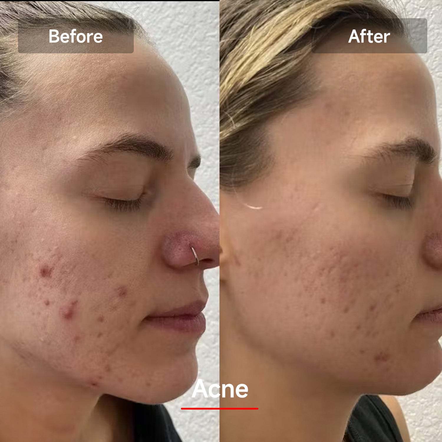 Veonskin LED Face Mask Pro – 7-Color Light Therapy for Skincare