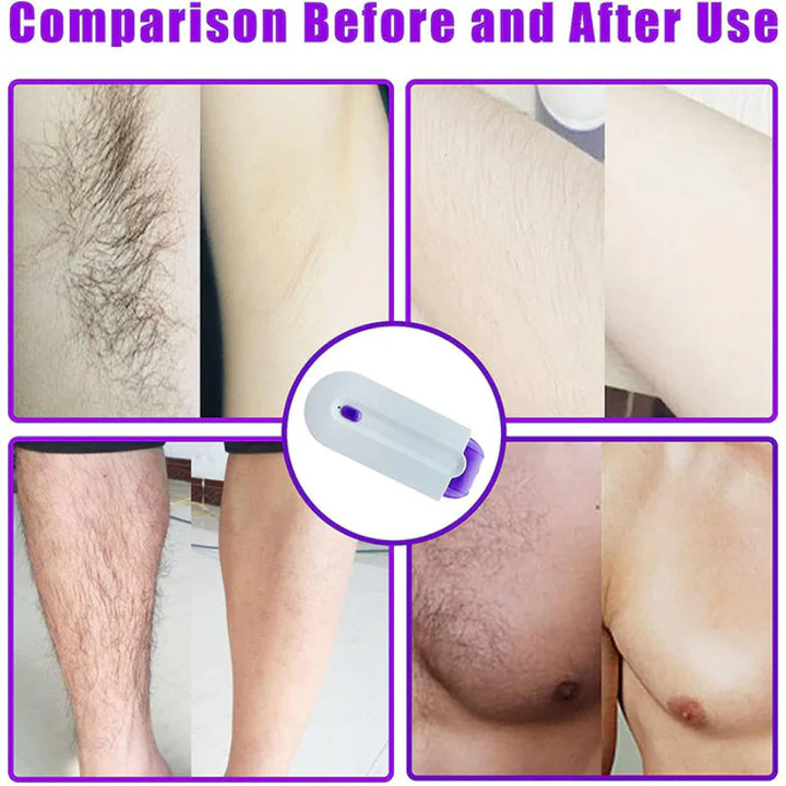 SmoothShaver – Multi-Purpose, Smooth, Gentle, Painless Hair Removal Shaver