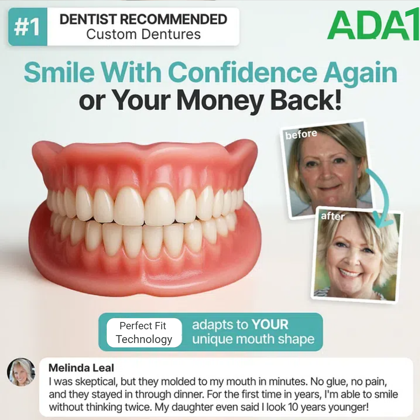 ROSOPL™Advanced Custom-Fit Denture Set image ROSOPL™Advanced Custom-Fit Denture Set