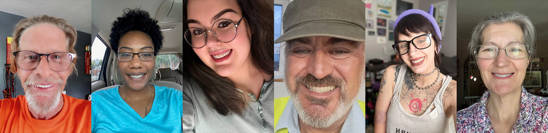 ROSOPL™ Custom-Fit Full Functional Dentures image ROSOPL™ Custom-Fit Full Functional Dentures